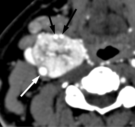 Fig 6.