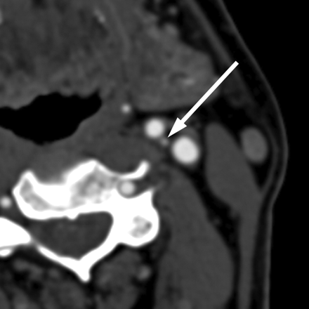 Fig 7.