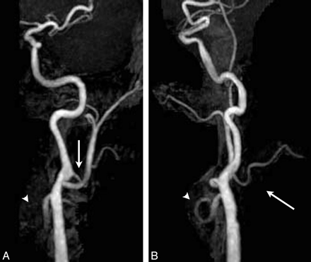 Fig 1.