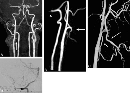 Fig 2.