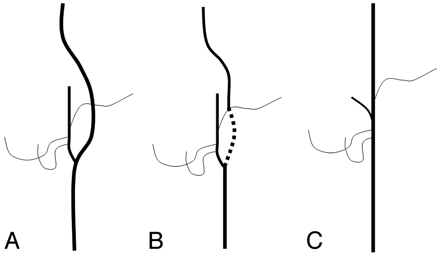 Fig 3.