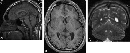 Fig 1.