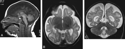 Fig 3.