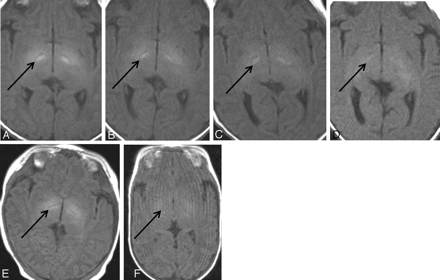 Fig 1.