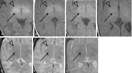 Fig 2.