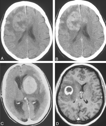 Fig 2.