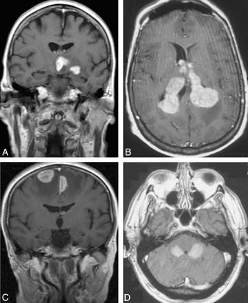 Fig 3.