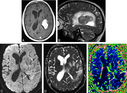 Fig 6.