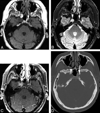 Fig 2.
