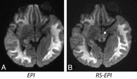 Fig 4.
