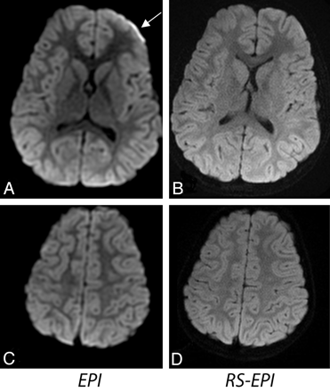 Fig 8.