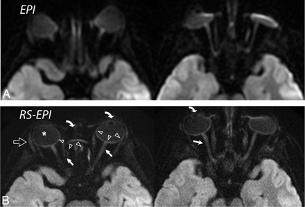 Fig 9.