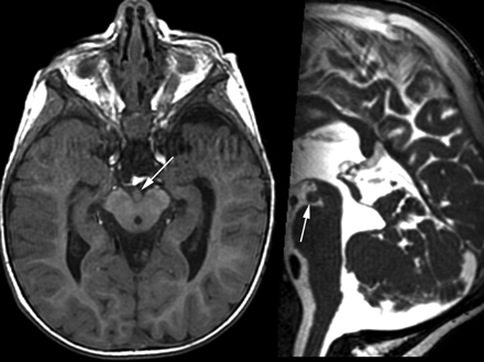 Fig 2.