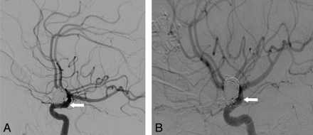 Fig 3.