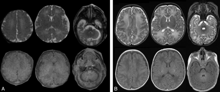 Fig 3.