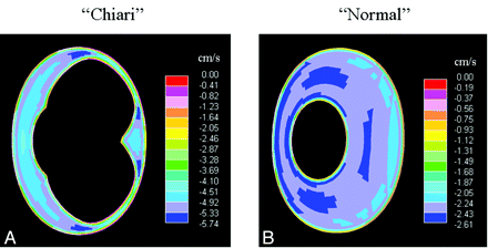 Fig 3.