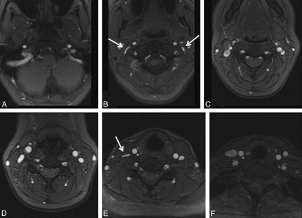 Fig 3.