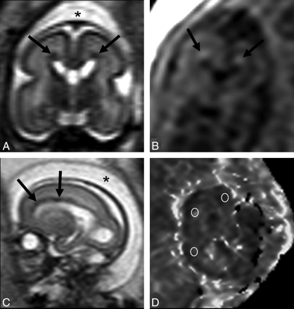 Fig 2.