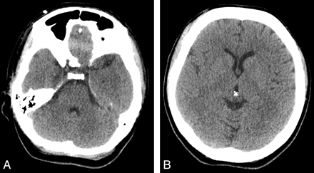 Fig 1.