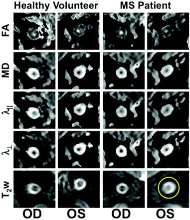 Fig 1.
