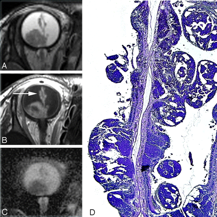 Fig 3.