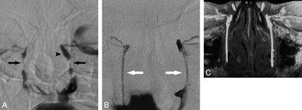 Fig 3.