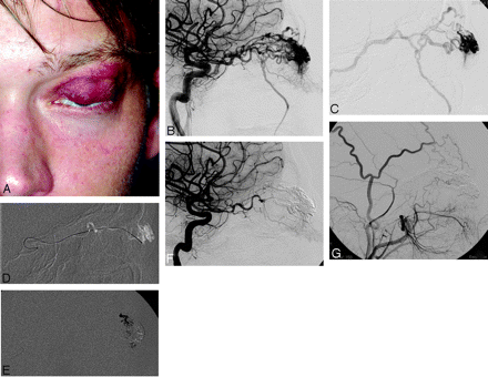 Fig 3.