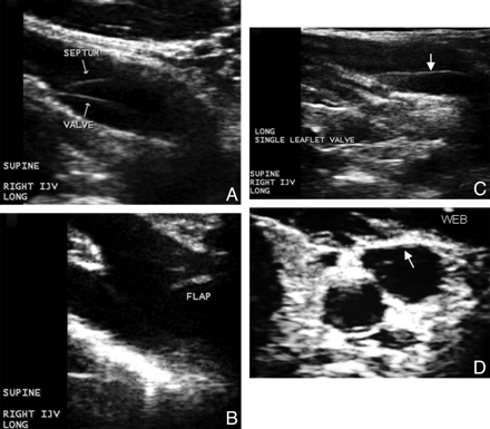 Fig 2.