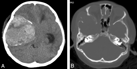 Fig 1.