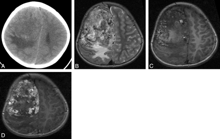 Fig 2.