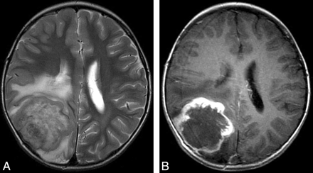 Fig 3.