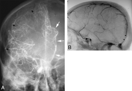 Fig 4.