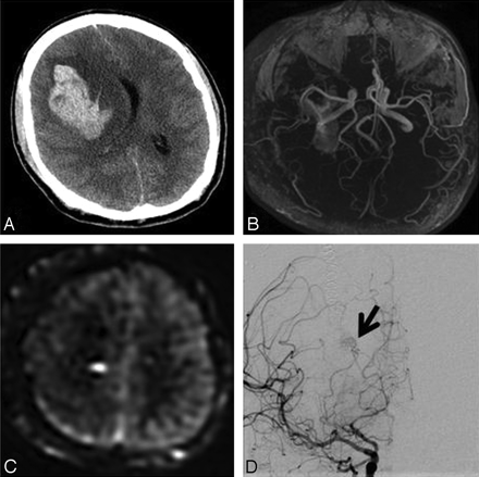 Fig 2.