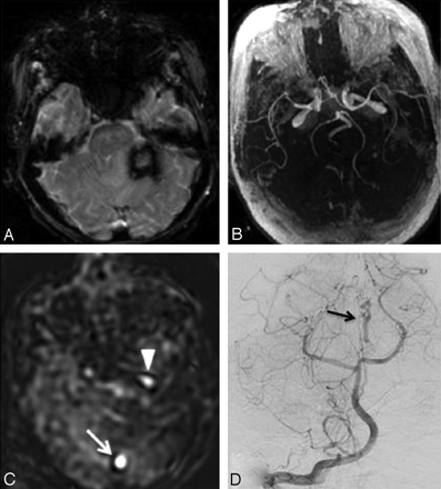 Fig 3.