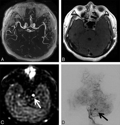 Fig 6.