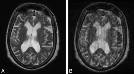 Fig 3.