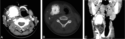 Fig 1.