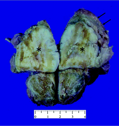 Fig 2.