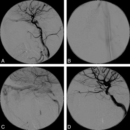 Fig 2.