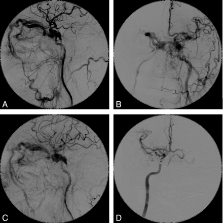 Fig 3.