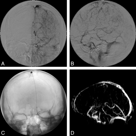 Fig 4.
