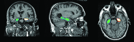 Fig 1.