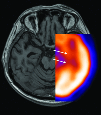 Fig 3.
