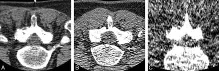 Fig 2.