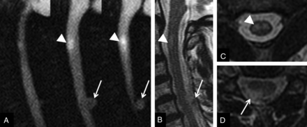 Fig 2.