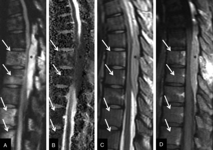 Fig 3.