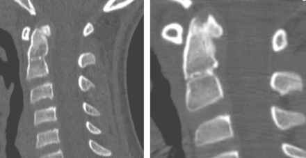 Fig 12.