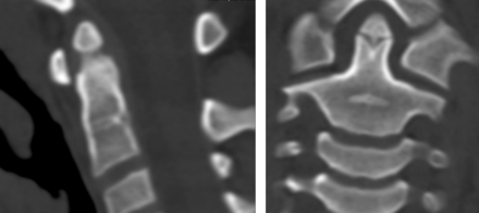 Fig 13.