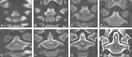 Fig 9.