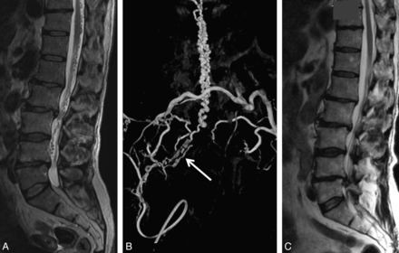 Fig 2.